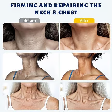 Roller Massage Neck Cream 🧴 Collagen & Hyaluronic Acid | Firms Neck, Reduces Wrinkles