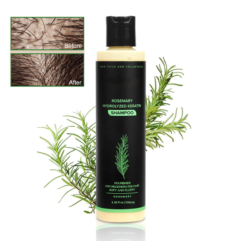 🔖Buy 5 Get 5 Free🧴Newly upgraded Rosemary Hair Growth Shampoo - suitable for all types of hair loss