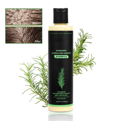 🔖Buy 5 Get 5 Free🧴Newly upgraded Rosemary Hair Growth Shampoo - suitable for all types of hair loss