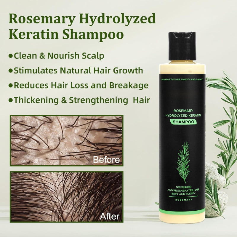 🔖Buy 5 Get 5 Free🧴Newly upgraded Rosemary Hair Growth Shampoo - suitable for all types of hair loss