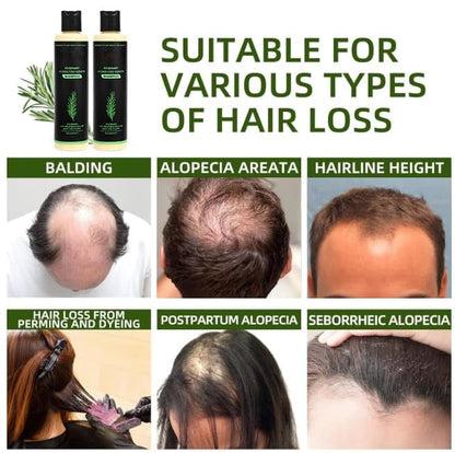 🔖Buy 5 Get 5 Free🧴Newly upgraded Rosemary Hair Growth Shampoo - suitable for all types of hair loss