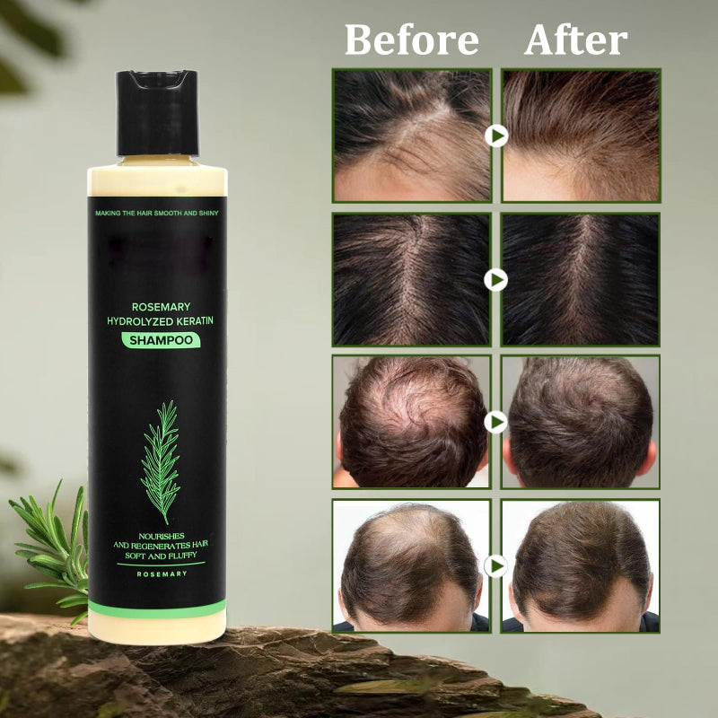 🔖Buy 5 Get 5 Free🧴Newly upgraded Rosemary Hair Growth Shampoo - suitable for all types of hair loss