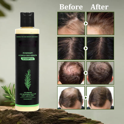 🔖Buy 5 Get 5 Free🧴Newly upgraded Rosemary Hair Growth Shampoo - suitable for all types of hair loss
